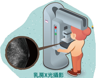 乳房X光攝影